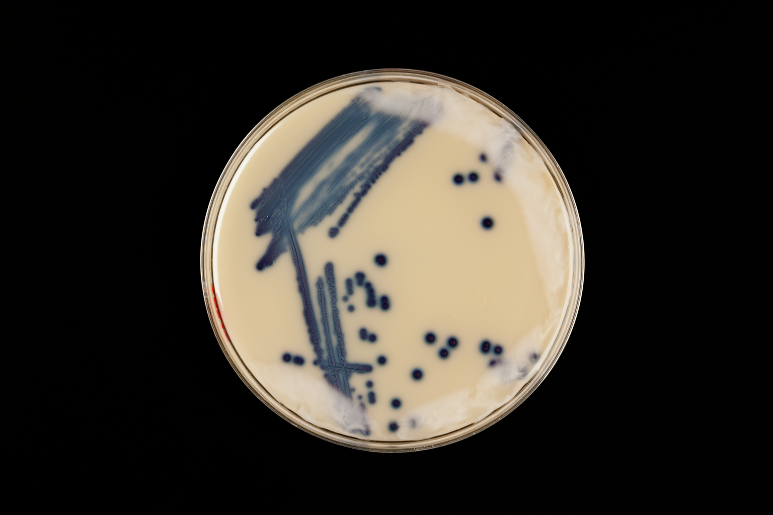 Супермикробы: борьба за жизнь – афиша